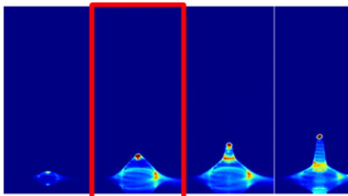 Auf dem Bild sieht man einen Laser-induzierter Transfer einer fluoreszenzmarkieren humanen Zelle