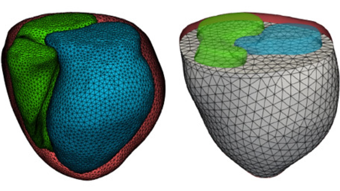 Grafik zeigt ein digitales Herzmodell (Grafik: Ludwig Wagmüller) Grafik zeigt ein digitales Herzmodell